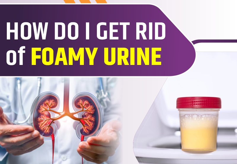 How Do I Get Rid of Foamy Urine